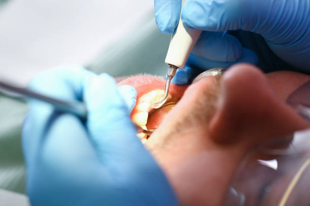 Best Mobile Emergency Dentist in Holland, TX