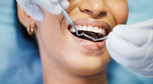 Best Emergency Dental Care for Abscessed Tooth in Holland, TX